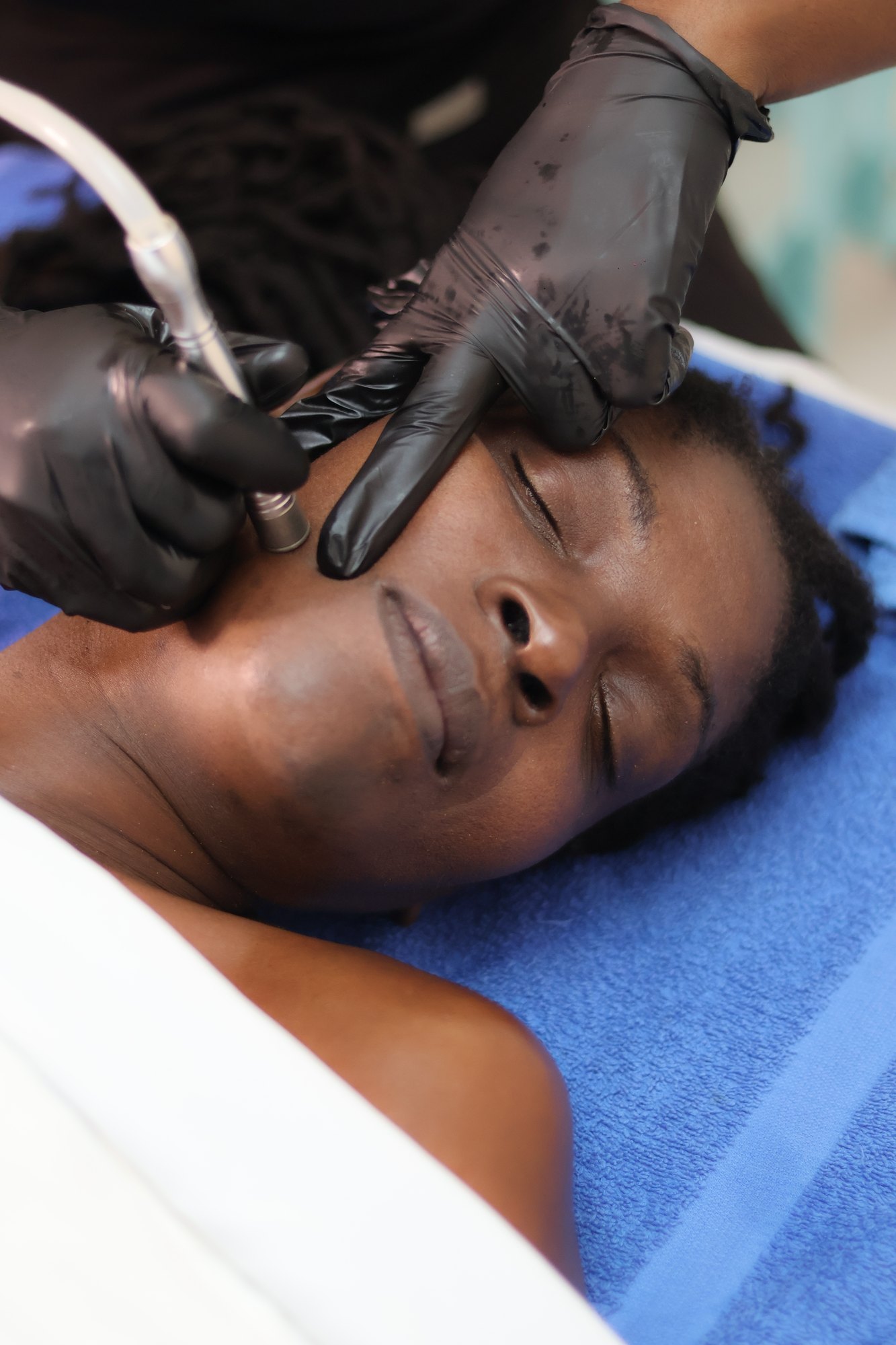 Microdermabrasion facial at KiWest Spa in Bridgetown, Barbados